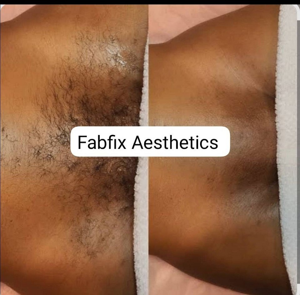 Smooth Fresh and Silky when you wax at Fabfix Aesthetics